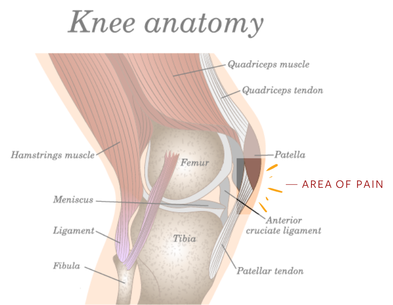pain under lower knee cap