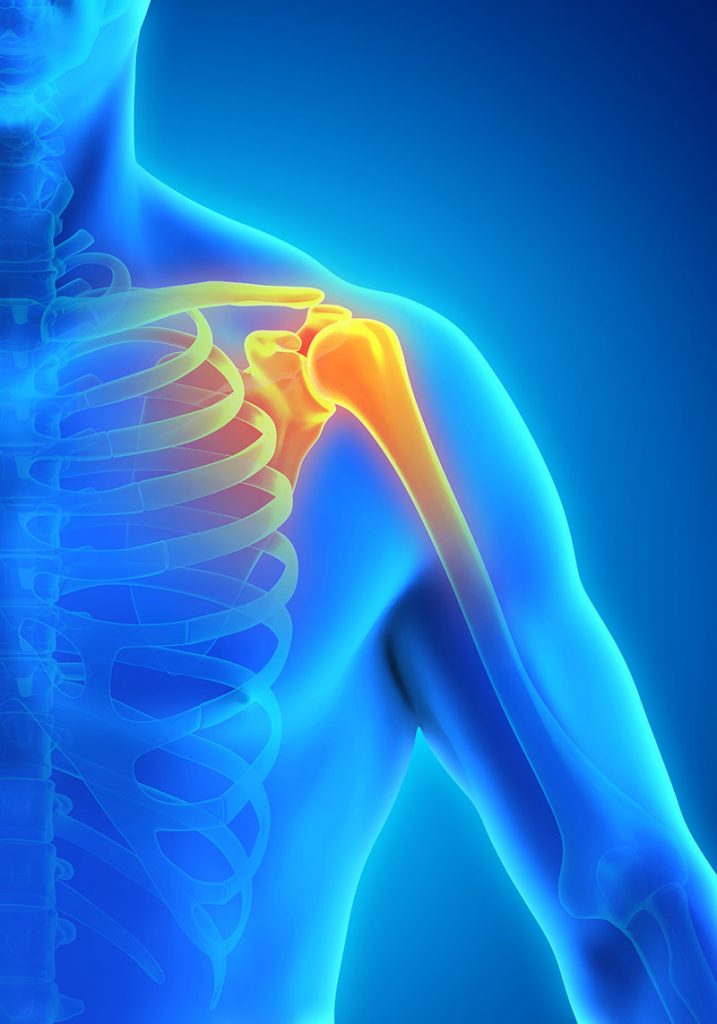 Shoulder Pain | Shoulder Injury | Shoulder Surgeon