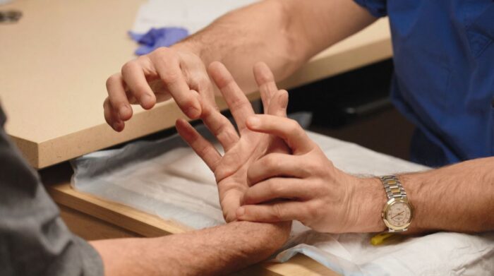 Doctor examining patient's hand for Dupuytren's Contracture
